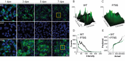 Subcellular distribution for WT and P79S ORF2 protein in electroporated HepG2 cells.