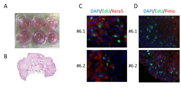 Radiation induced kinase signaling