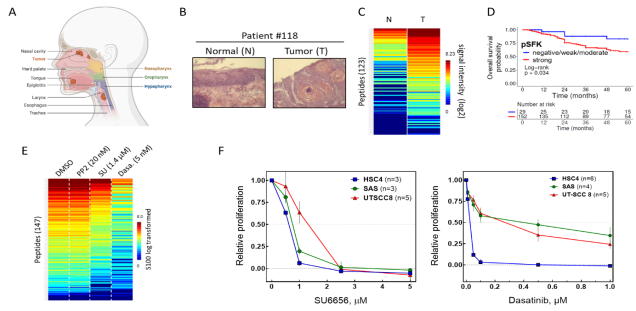 Radiation induced kinase signaling